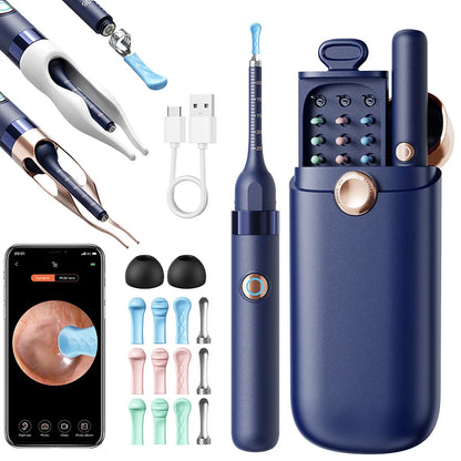 Smart Visual Ear Wax Cleaner with 800W HD Camera – Multi-Functional Ear Cleaning Tool
