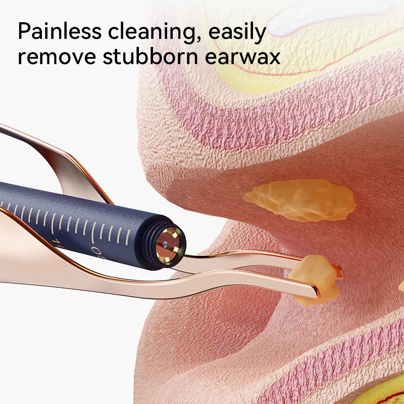 Smart Visual Ear Wax Cleaner with 800W HD Camera – Multi-Functional Ear Cleaning Tool