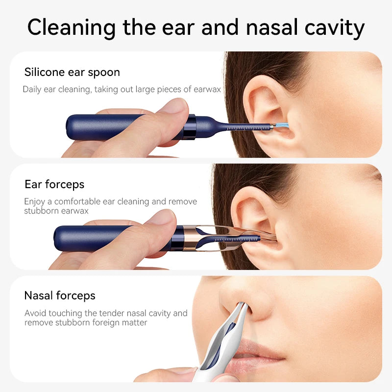 Smart Visual Ear Wax Cleaner with 800W HD Camera – Multi-Functional Ear Cleaning Tool